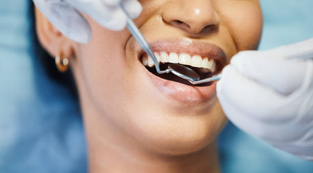 Best Emergency Denture Repair in Calabash, NC
