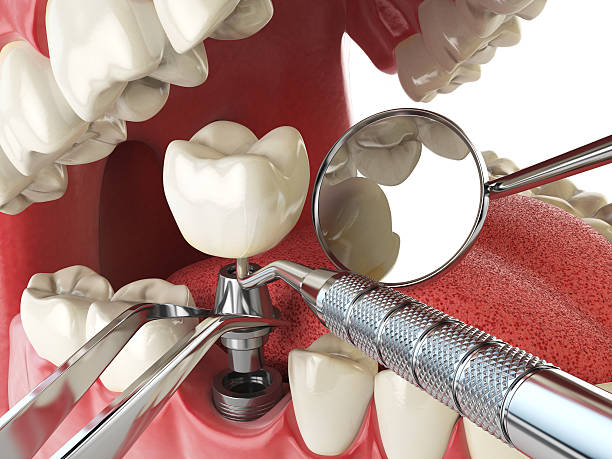 Best Emergency Treatment for Dental Infections or Abscesses in Calabash, NC