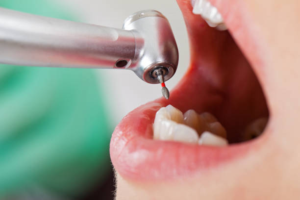 Best Weekend Emergency Dentist in Calabash, NC